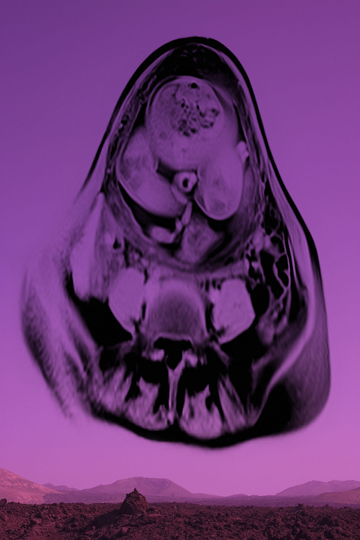 xxx